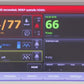 Welch Allyn® Connex® Integrated Wall System - Braun ThermoScan 6000 Diagnostic Sets Welch Allyn